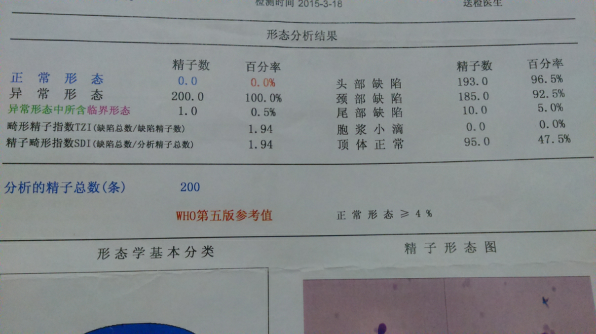 备孕男士锌硒宝（男士备孕锌硒宝片十大排行）-硒宝网