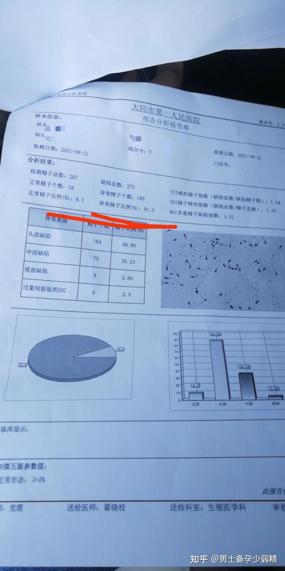 备孕男士锌硒宝（男士备孕锌硒宝片十大排行）-硒宝网