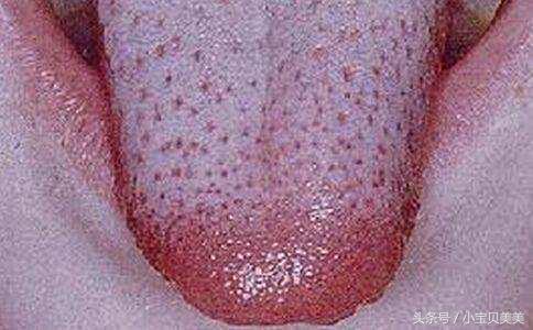 锌硒宝配生精片(锌硒宝和生精胶囊一样吗)-硒宝网