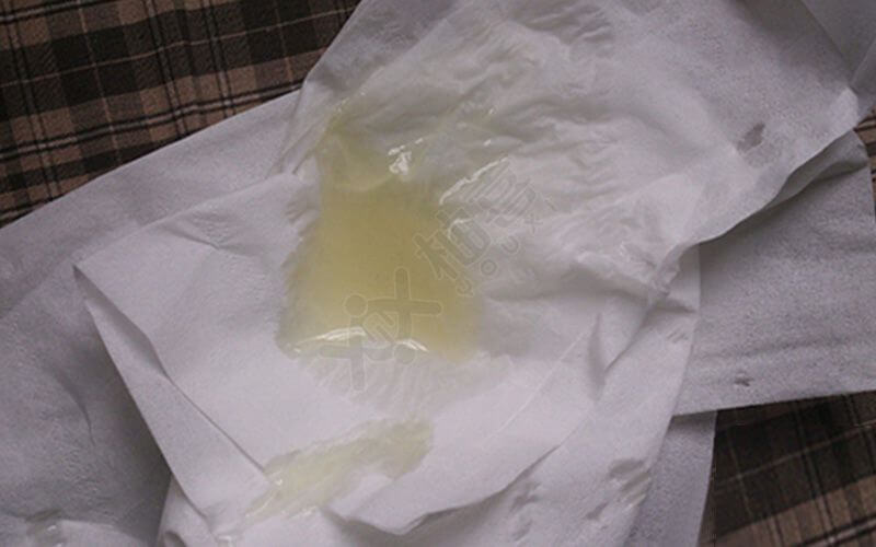 锌硒宝碘蛋白质（蛋白锌锌硒宝）-硒宝网