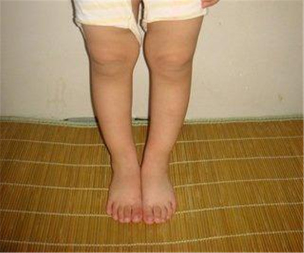 锌硒宝片二周岁(锌硒宝片一周岁宝宝能吃吗)-硒宝网