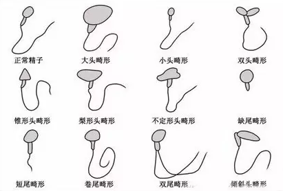 锌硒宝能提高精子(锌硒宝能提高精子)-硒宝网