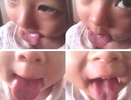 锌硒宝有副作用吗(锌硒宝有什么副作用)-硒宝网