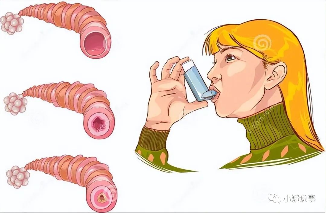 硒酵母是补硒的吗(硒酵母是补充什么的)-硒宝网