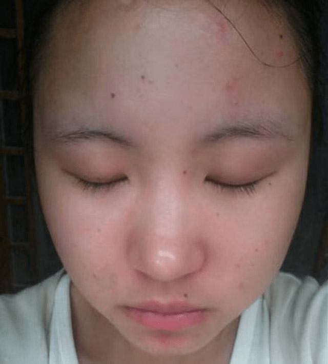 补硒伤害肝脏吗吗(硒对肝病有什么好处)-硒宝网