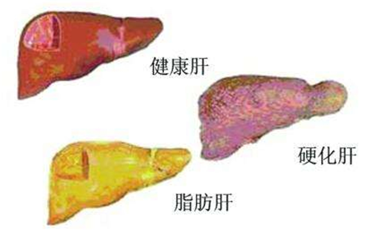 补硒可以解酒护肝（补解酒护肝硒可以喝吗）-硒宝网