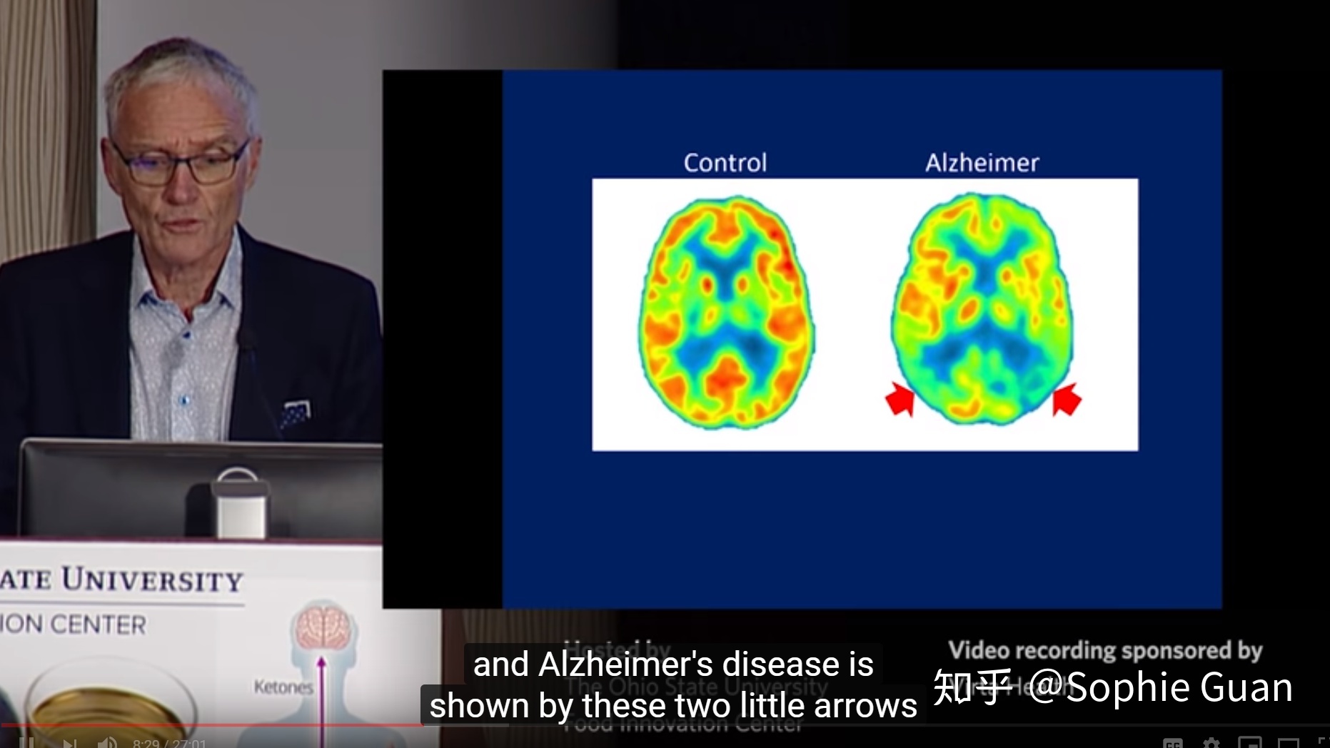 预防老年痴呆补硒(预防补老年痴呆硒的作用)-硒宝网