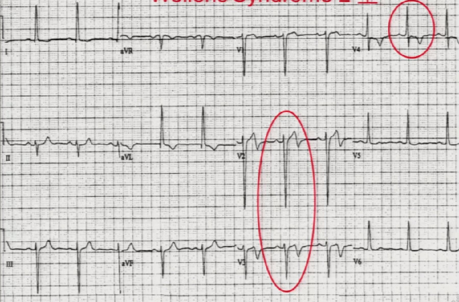 补硒对心脏病好吗（心脏不好的人能补硒吗）-硒宝网