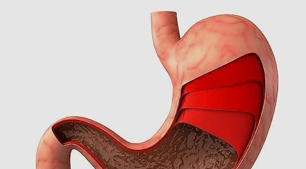 疱疹补硒能有用吗(长疱疹是否补锌)-硒宝网