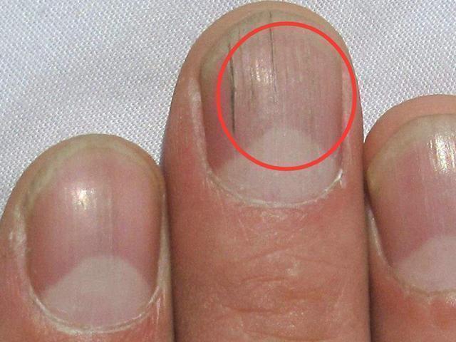 硒麦芽补硒解毒素(麦芽硒中毒)-硒宝网