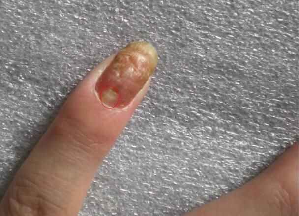 硒麦芽补硒解毒素(麦芽硒中毒)-硒宝网