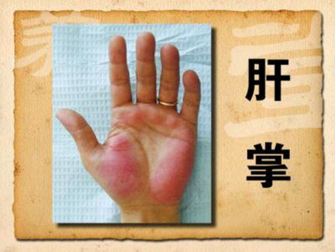 硒麦芽补硒解毒素(硒麦芽的副作用)-硒宝网