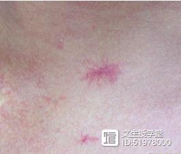 硒麦芽补硒解毒素（硒麦芽有毒吗）-硒宝网