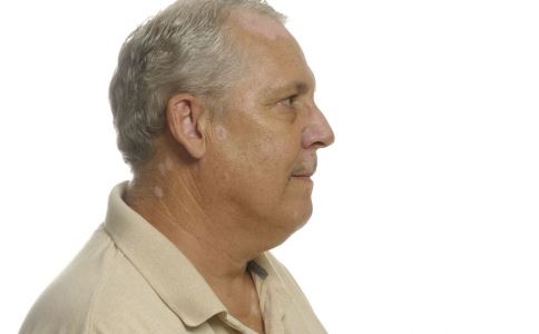 每天补多少硒男性(每天男性补硒多少克)-硒宝网