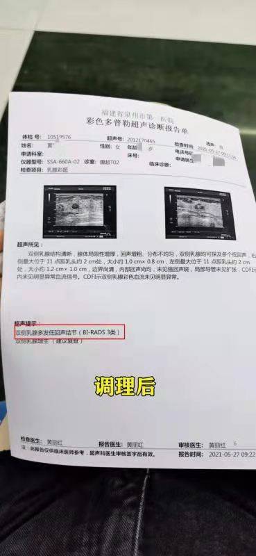 乳腺结节怎样补硒（补硒乳腺结节）-硒宝网