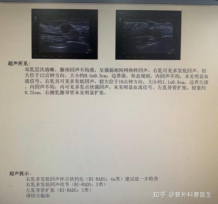 乳腺结节怎样补硒（补硒乳腺结节）-硒宝网