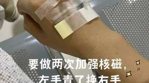 肝癌术后怎么补硒（肝癌吃硒有效果吗）-硒宝网