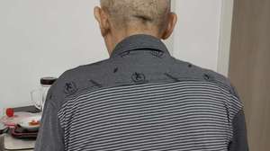 肝癌术后怎么补硒（肝癌吃硒有效果吗）-硒宝网