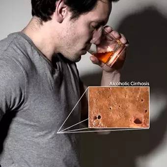 转氨酶高能补硒吗（补转氨酶高能硒片吃吗）-硒宝网