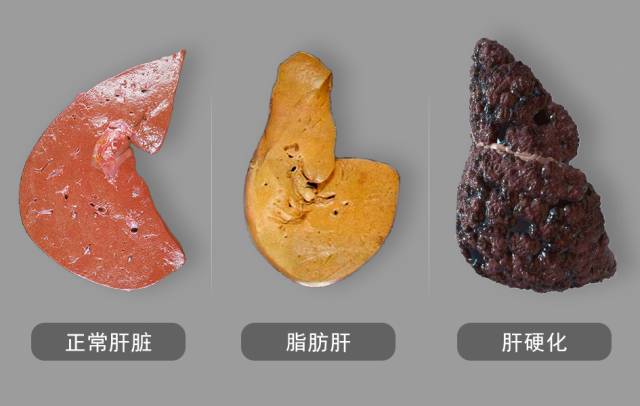 转氨酶高能补硒吗（转氨酶高可以吃硒保健品吗）-硒宝网