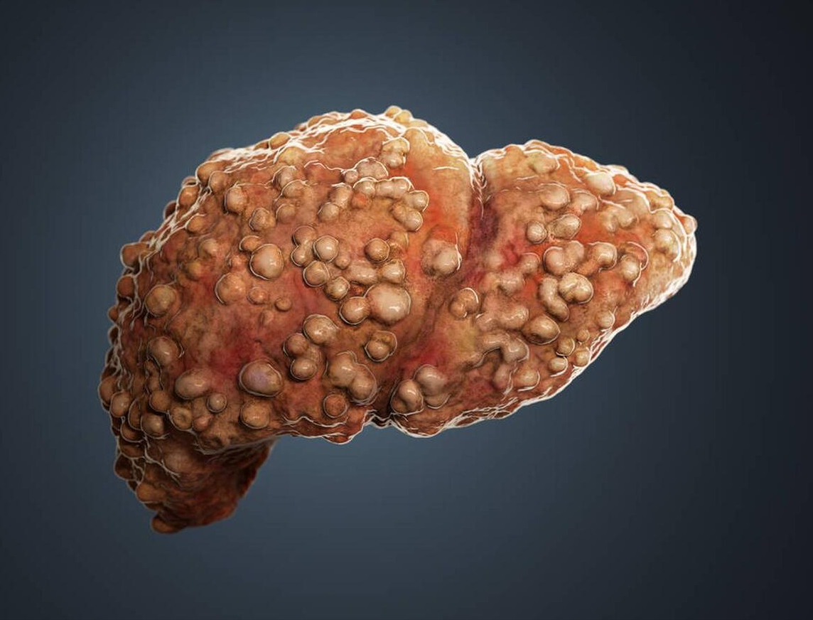 预防肝病怎么补硒（预防补肝病硒的药物）-硒宝网