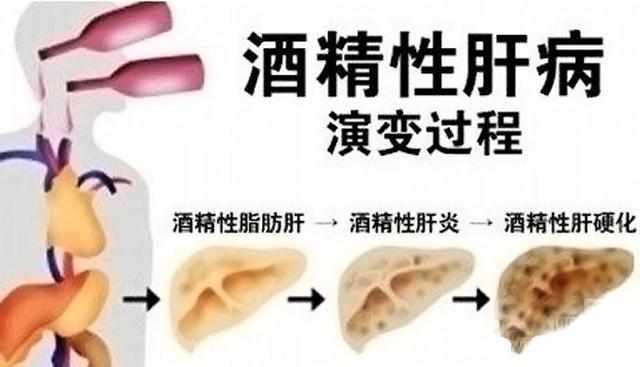 补硒过量导致耳鸣(哪些品牌的补硒是有机硒)-硒宝网