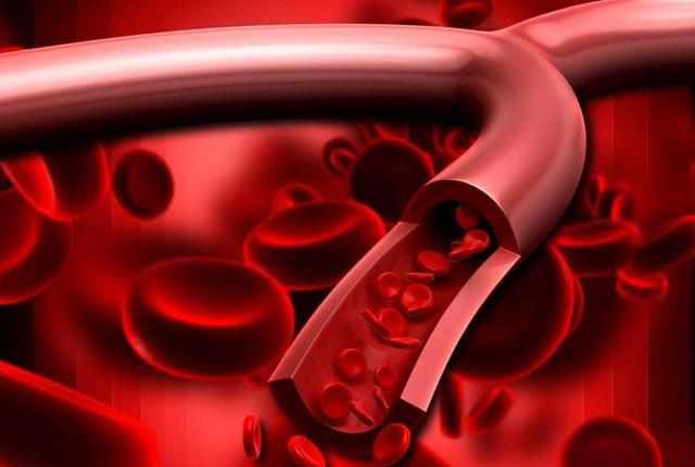 补硒过量导致耳鸣(哪些品牌的补硒是有机硒)-硒宝网