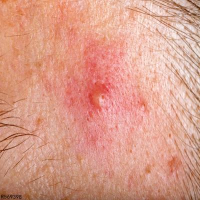 补硒好转反应名句(补硒好转反应名句)-硒宝网