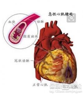 桥本甲亢补硒用药（桥本甲状腺补硒）-硒宝网