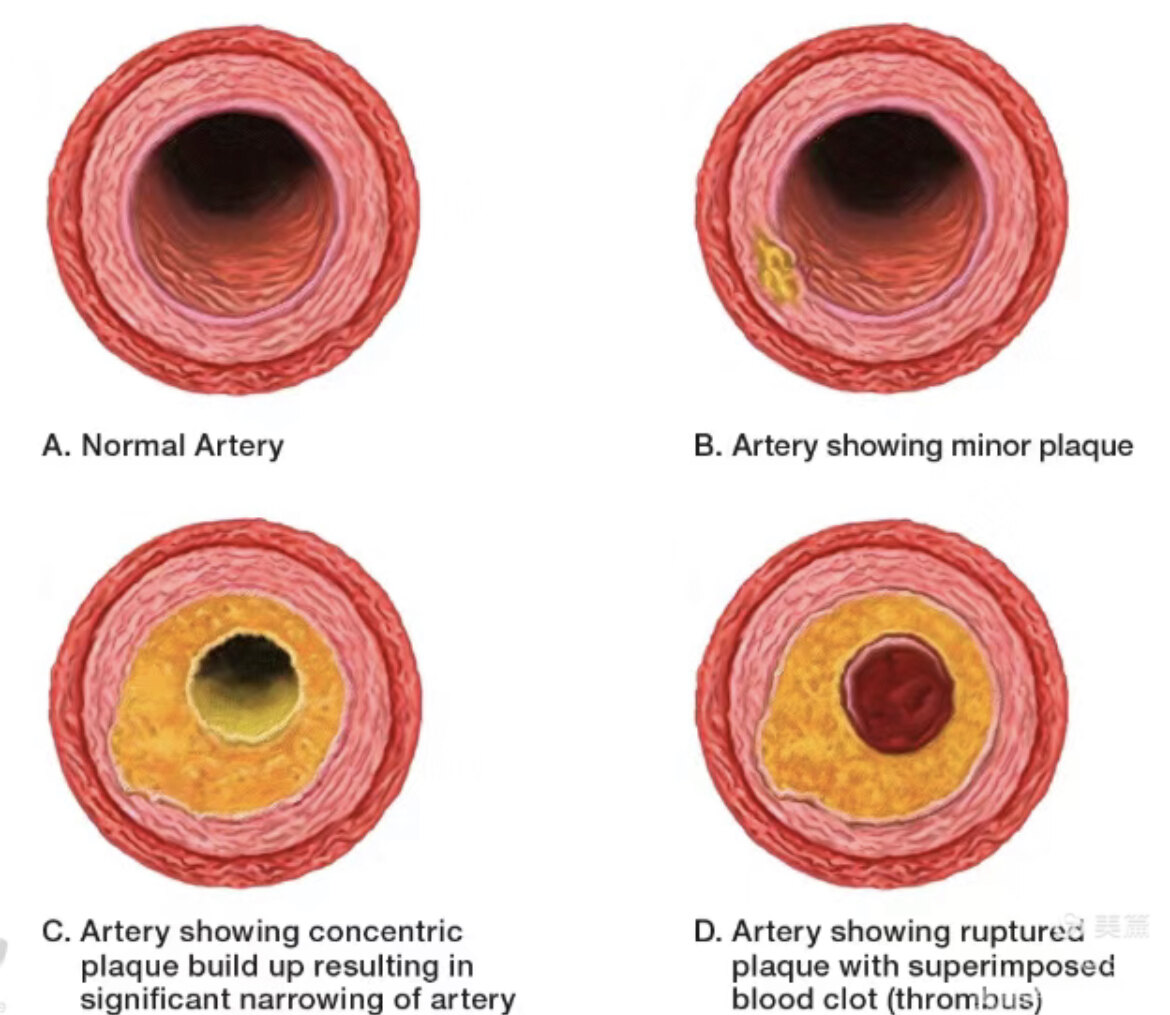补硒造成血压降低(血压低可以吃硒吗)-硒宝网