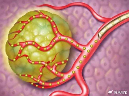 肝癌患者补硒产品(补肝癌患者产品硒片有用吗)-硒宝网