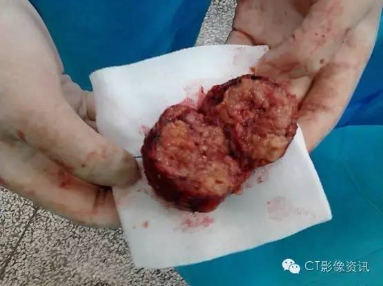 预防大于治疗补硒(如何预防硒缺乏)-硒宝网