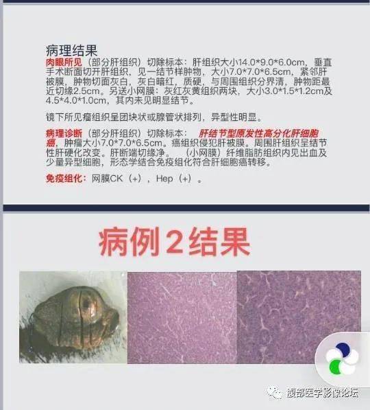 预防大于治疗补硒(如何预防硒缺乏)-硒宝网