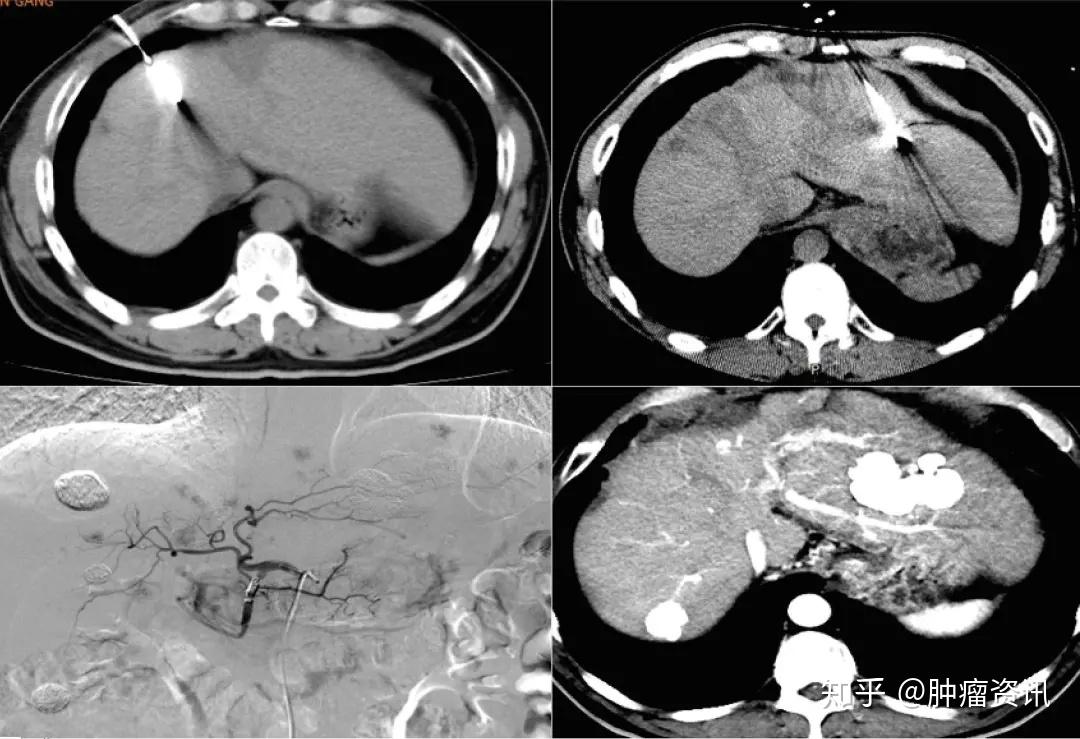 预防大于治疗补硒(如何预防硒缺乏)-硒宝网