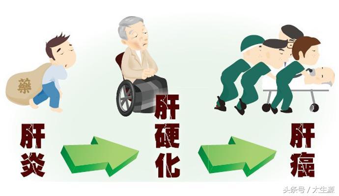 肝炎患者需要补硒（补肝炎患者需要硒元素吗）-硒宝网