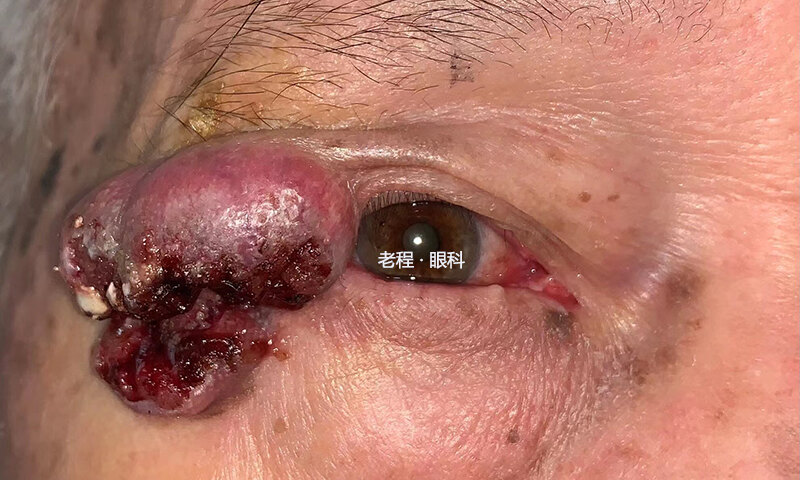 缺少硒元素如何补（缺少元素硒的症状）-硒宝网