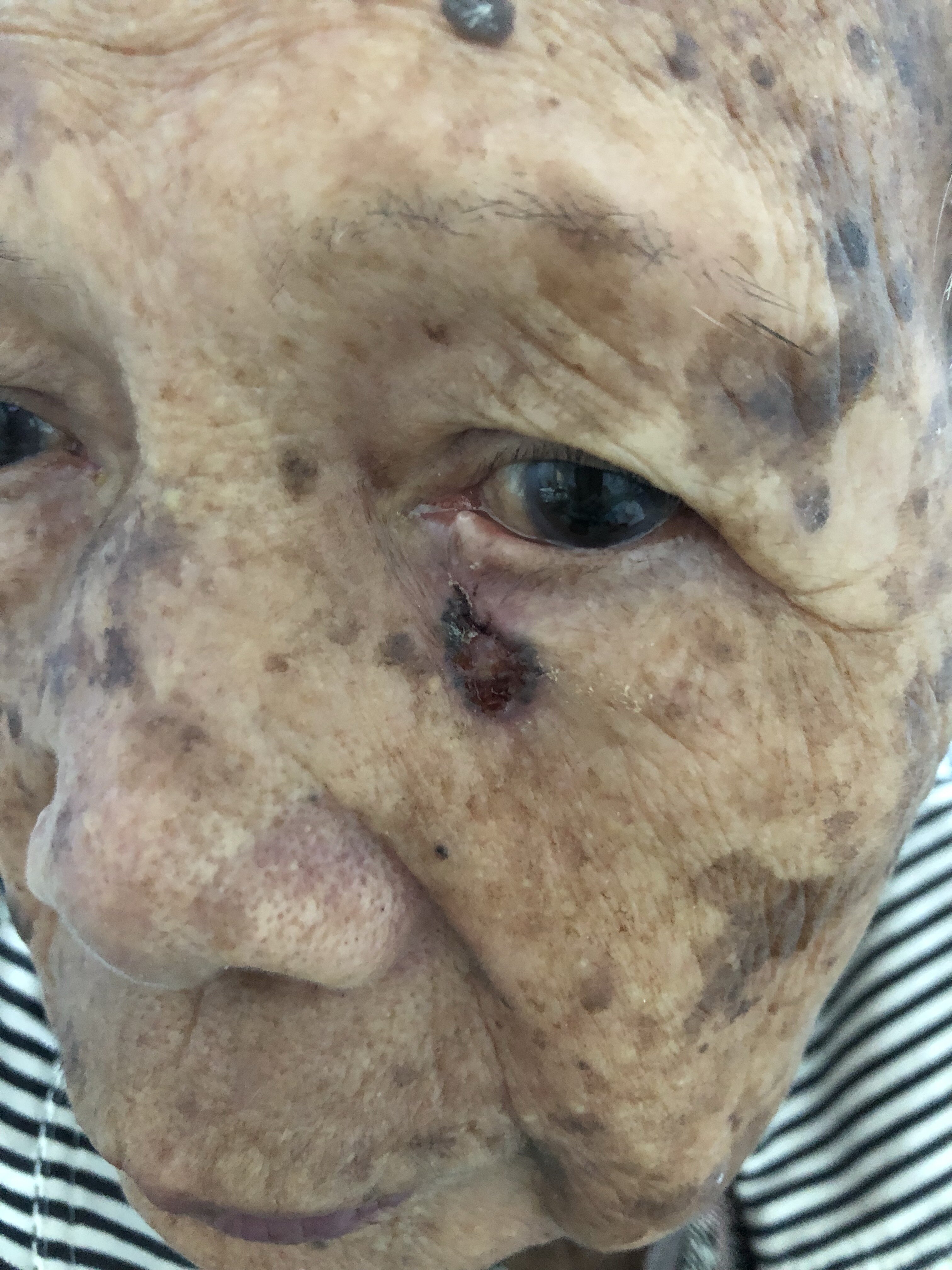 缺少硒元素如何补（缺少元素硒的症状）-硒宝网