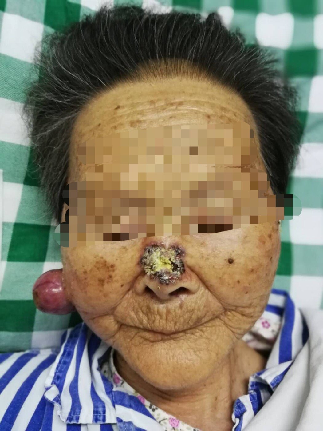 缺少硒元素如何补（缺少元素硒的症状）-硒宝网