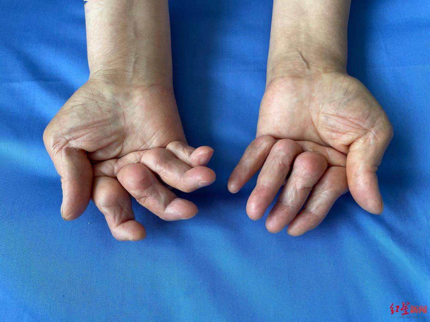 全民补硒国家文件（全民补硒健康工程管理办公室）-硒宝网