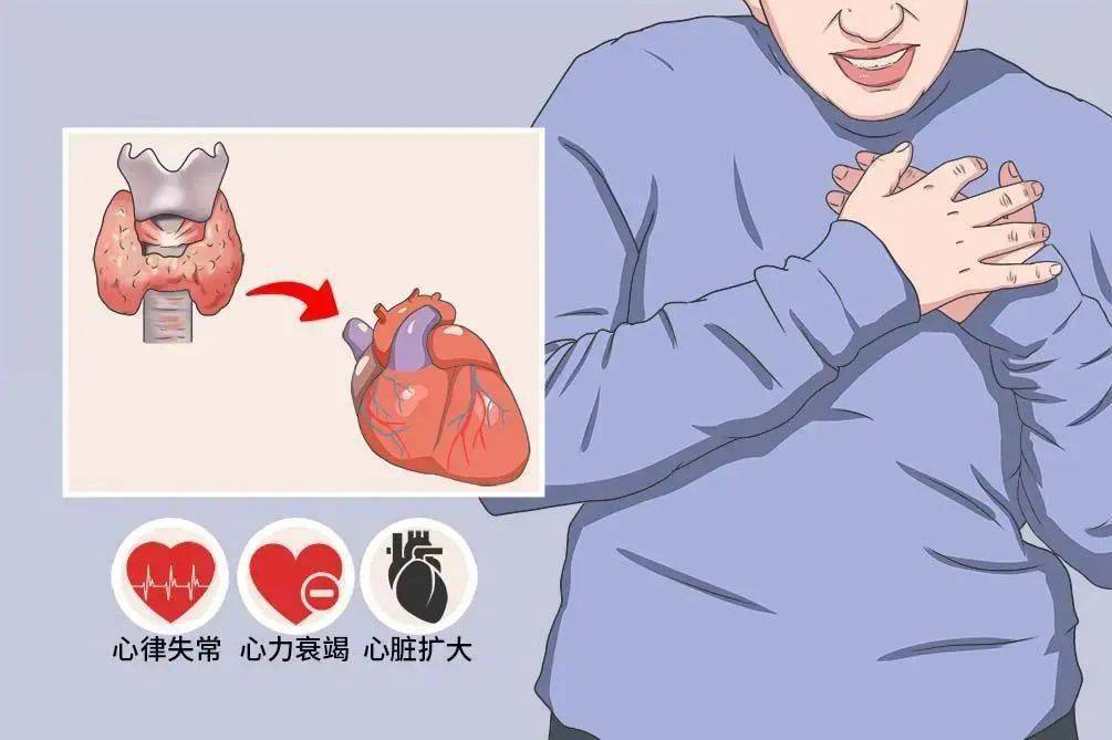 甲亢患者补硒天然（补硒对甲亢有好处吗）-硒宝网