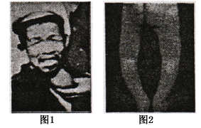 补硒补碘一样重要(补硒的重要性和必要性)-硒宝网