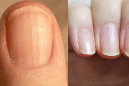 补硒和补钙的区别(钙硒同补)-硒宝网