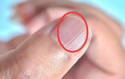 补硒和补钙的区别(钙硒同补)-硒宝网