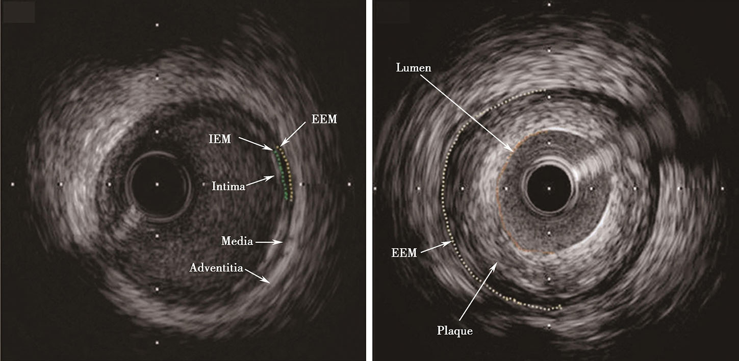 补硒的好处和害处(补硒的好处)-硒宝网