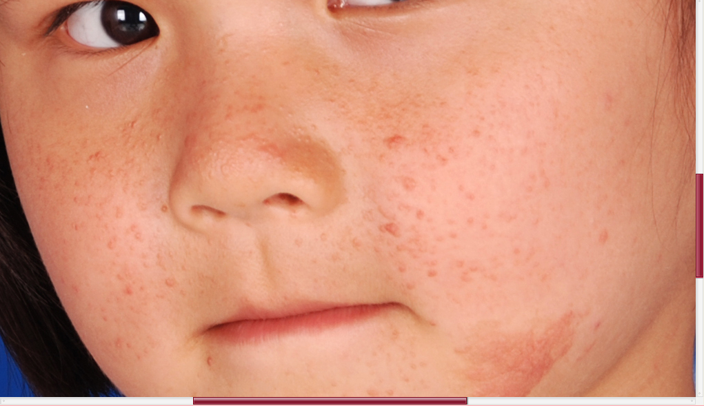 补硒的好处和害处(补硒的好处)-硒宝网