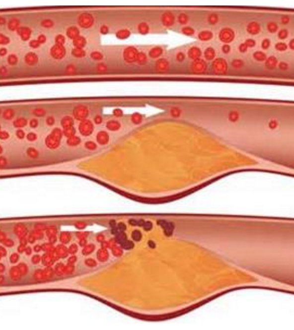 补硒的好处和害处(补硒的好处)-硒宝网