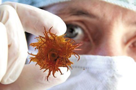 乳癌有必要补硒吗（乳腺癌补硒）-硒宝网