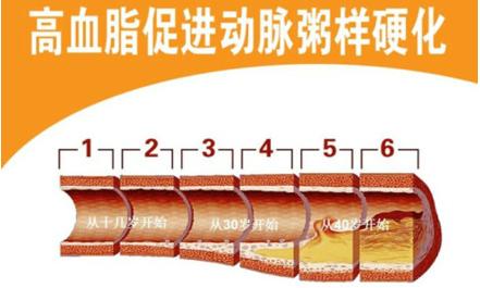 冠心病补硒量多少(冠心病可以补硒吗)-硒宝网