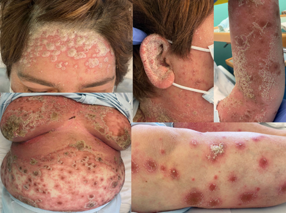 补硒会让皮肤好吗(补硒对皮肤)-硒宝网