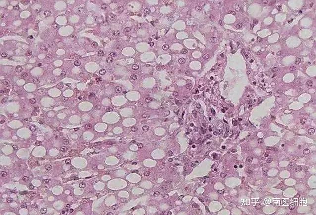 补硒会使人发胖吗(补硒会瘦吗)-硒宝网